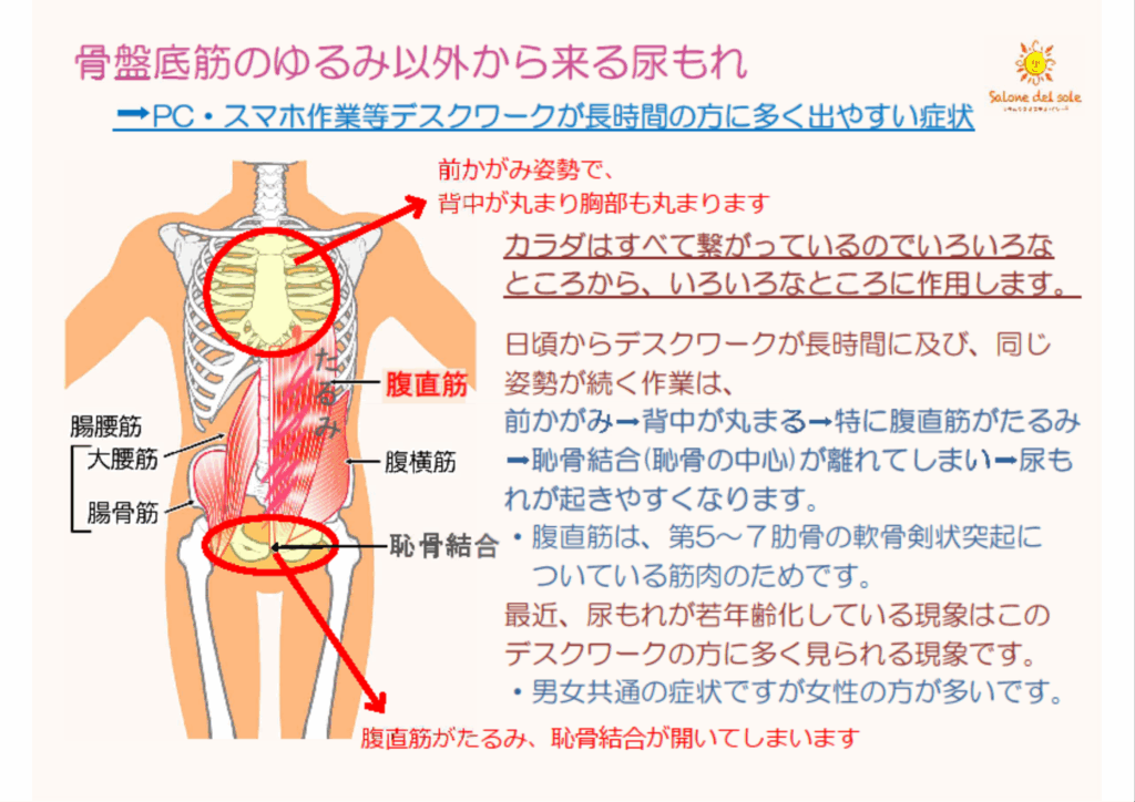 骨盤底筋のゆるみ以外からくる尿もれの図